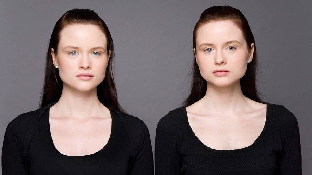 11 Different Types Of Twins That Really Exist In The World